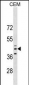 QPCT Antibody (C-term)